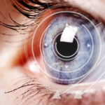 Grå starr (katarakt): orsak, symtom & behandling